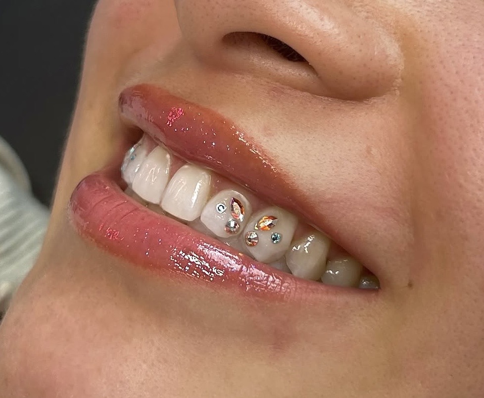Joias e piercings dentais